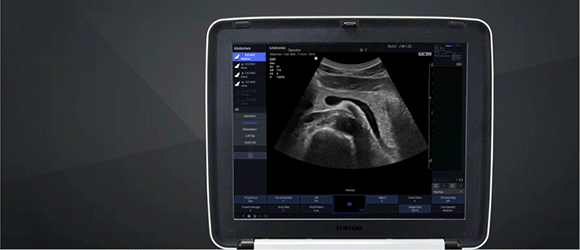 Breitbild (Scann Layour2), Vollbildmodus