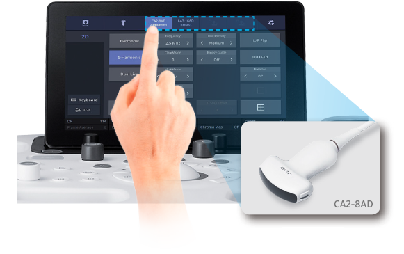 Finger zeigt auf Touchscreen von Ultraschallsystem HS40 und Convex-Sonde ist rechts vergrößert dargestellt.