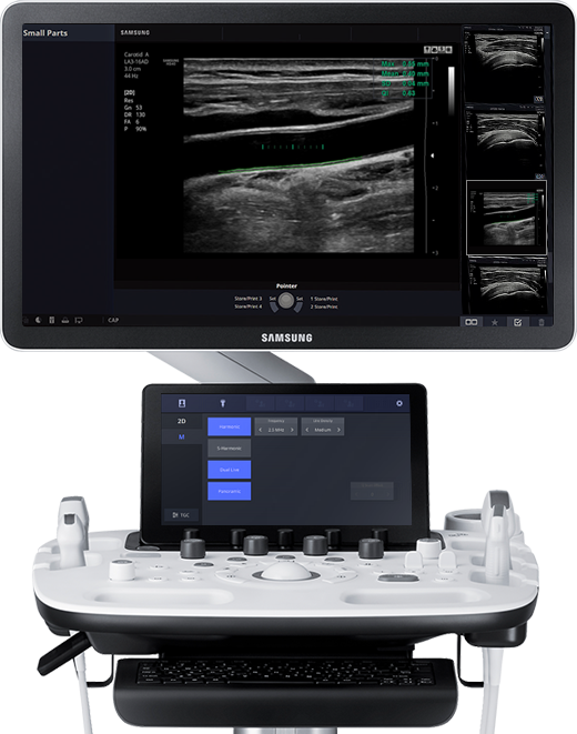 Ultraschallsystem HS40 Frontansicht mit Ultraschallbild ElastoScan von Samsung