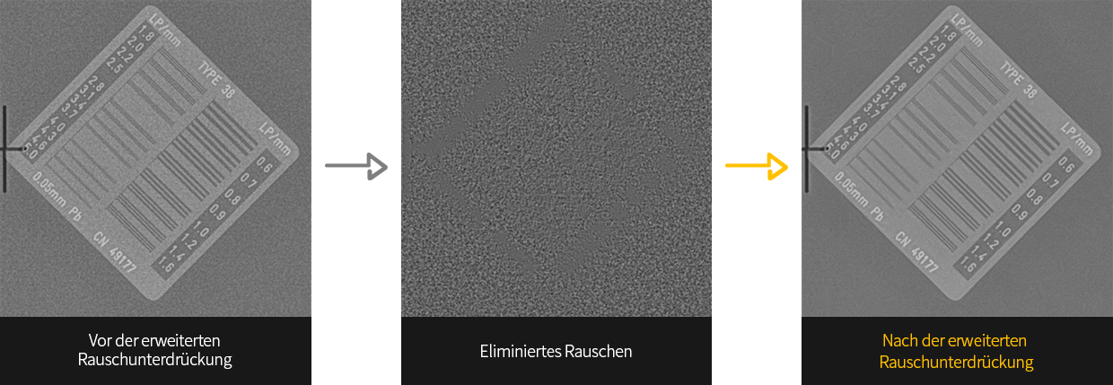 Darstellung der Bildverarbeitung unter Verwendung eines Linienpaar-Testphantoms Die Bildqualität (BRH score) bleibt fast unverändert (200 zu 199) bei halber Dosis und Verwendung der neuen Samsung S-Vue™ 3.02 Bildverarbeitung.