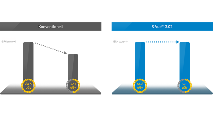 Die Bildqualität (BRH score) fällt von 199 auf 176 bei halber Dosis und konventioneller Bildverarbeitung