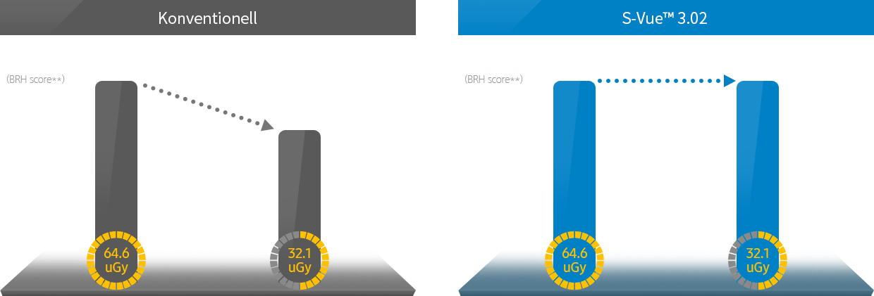 Die Bildqualität (BRH score) fällt von 199 auf 176 bei halber Dosis und konventioneller Bildverarbeitung