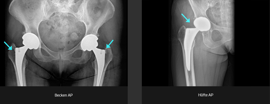 Röntgenbilder (Becken, Becken AP, Hüfte AP) aufgenommen mit digitalem Röntgengerät von Samsung.