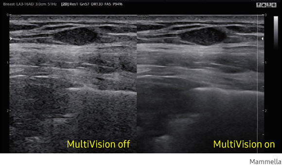 Immagine clinica della mammella ottenuta con software MultiVision