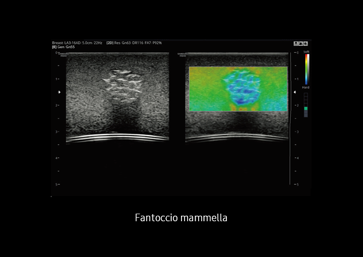 Immagine clinica di un fantoccio della mammella con Elastoscan