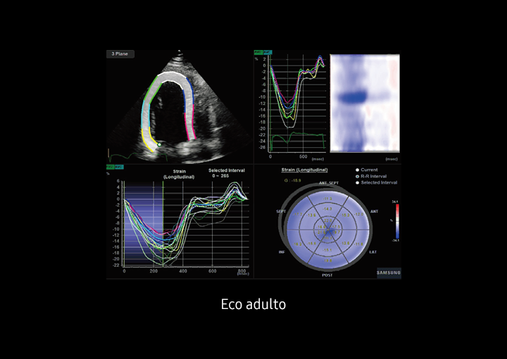 Immagine ecografica sull'adulto utilizzando Strain+