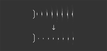 S-Vision Beamformer riceve segnali di ritorno attraverso un sofisticato sistema di filtraggio digitale, con conseguente riduzione dei lobi laterali e degli artefatti.