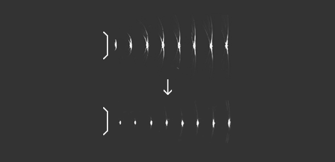S-Vision Beamformer riceve segnali di ritorno attraverso un sofisticato sistema di filtraggio digitale, con conseguente riduzione dei lobi laterali e degli artefatti.