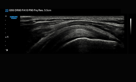 Immagine chiara e unifome con HQ Vision