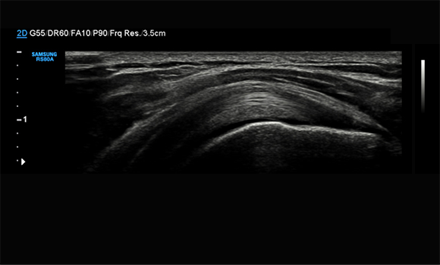 Immagine chiara e unifome con HQ Vision