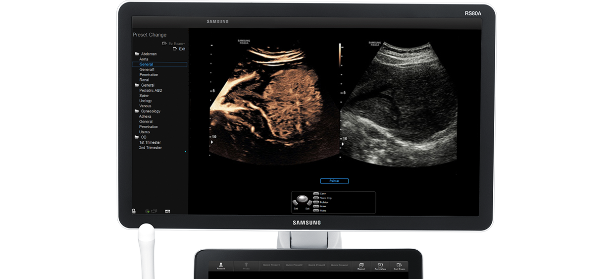 Immagine ottenuta con software CEUS+