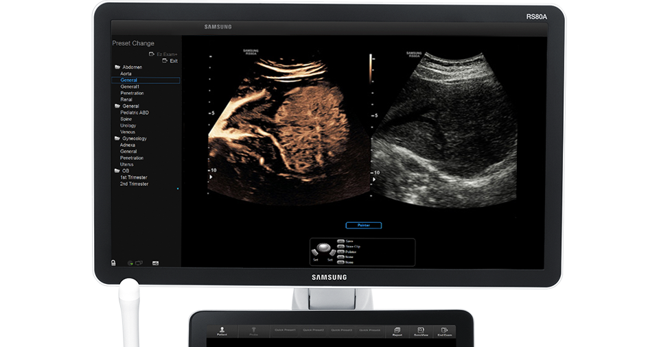 Immagine ottenuta con software CEUS+ 