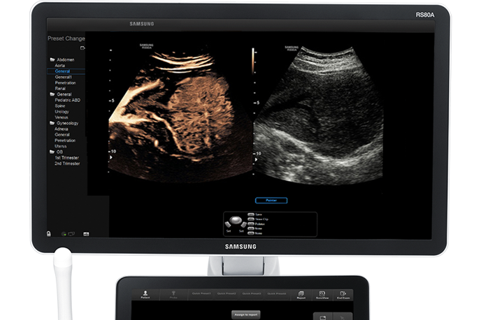 Immagine ottenuta con software CEUS+ 