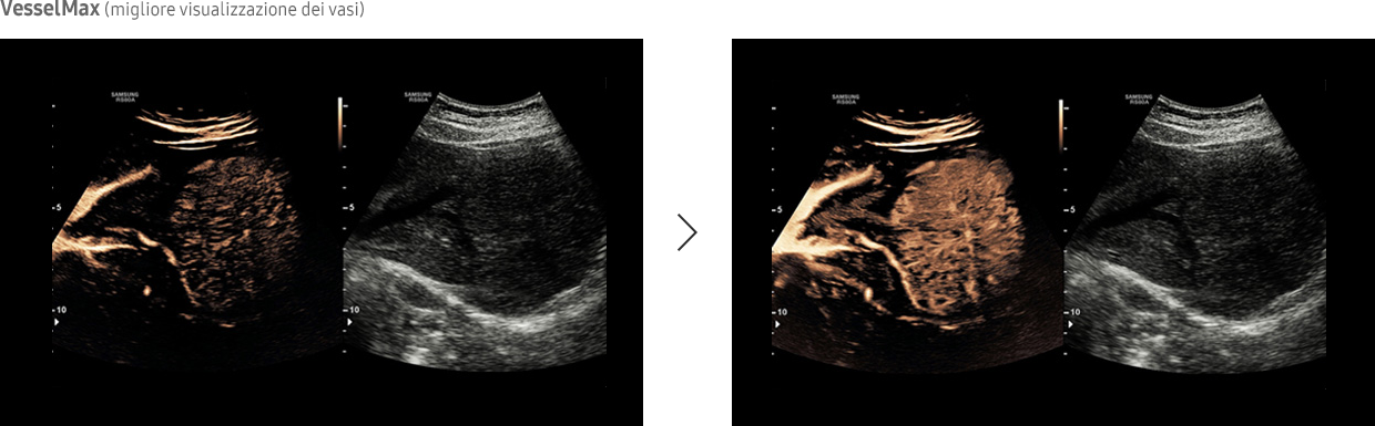 Immagine ottenuta con software CEUS+