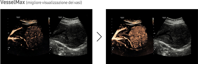 Immagine ottenuta con software CEUS+