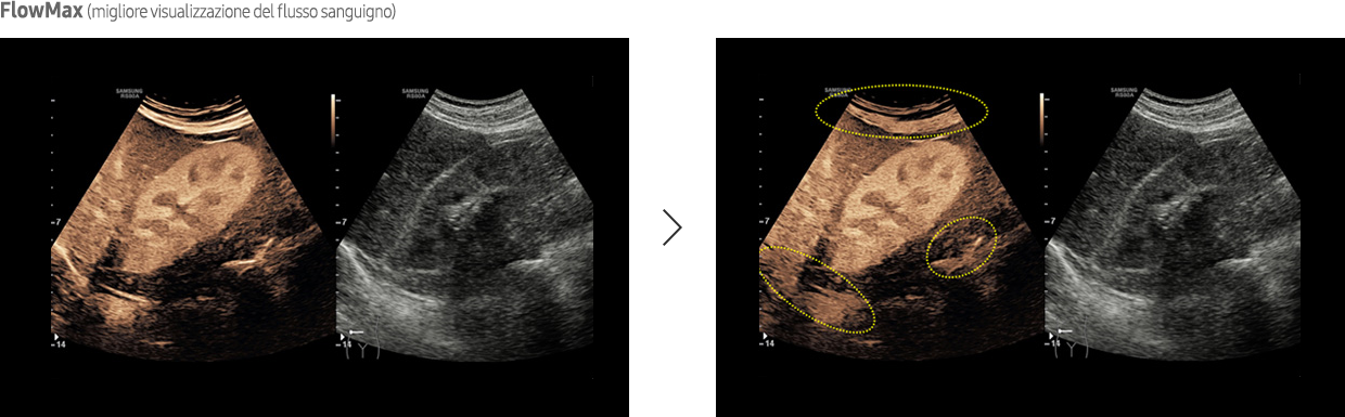 Immagine ottenuta con software CEUS+