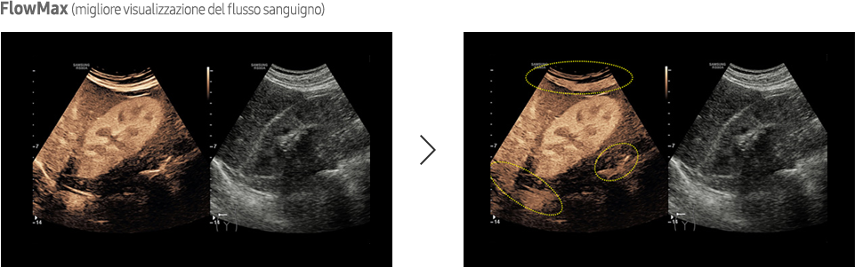 Immagine ottenuta con software CEUS+