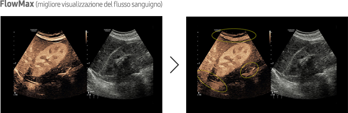 Immagine ottenuta con software CEUS+