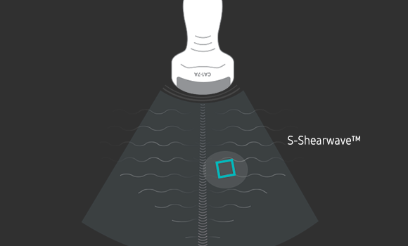 Azione della sonda con S-Shearwave nel tessuto