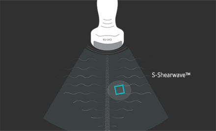 Azione della sonda con S-Shearwave nel tessuto