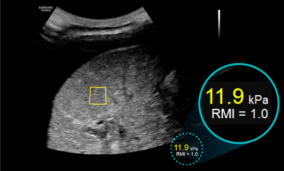 Informazioni quantitative sulle caratteristiche del tessuto