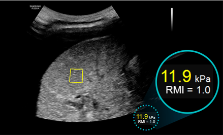 Informazioni quantitative sulle caratteristiche del tessuto