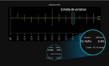 Informazioni quantitative sulle caratteristiche del tessuto