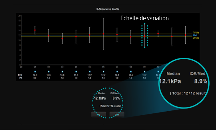 Informazioni quantitative sulle caratteristiche del tessuto