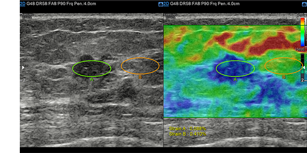 Immagini ottenute con software E-strain