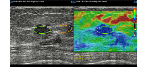 Immagini ottenute con software E-strain