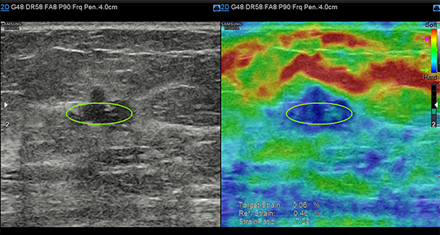 Immagini ottenute con software E-strain