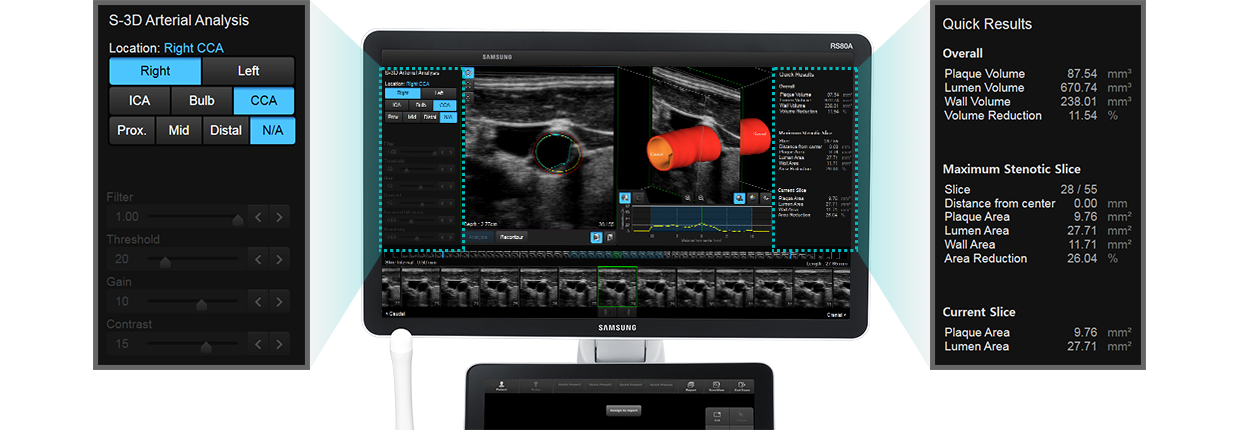 Immagini a monitor ottenute con software S-3D Arterial Analysis