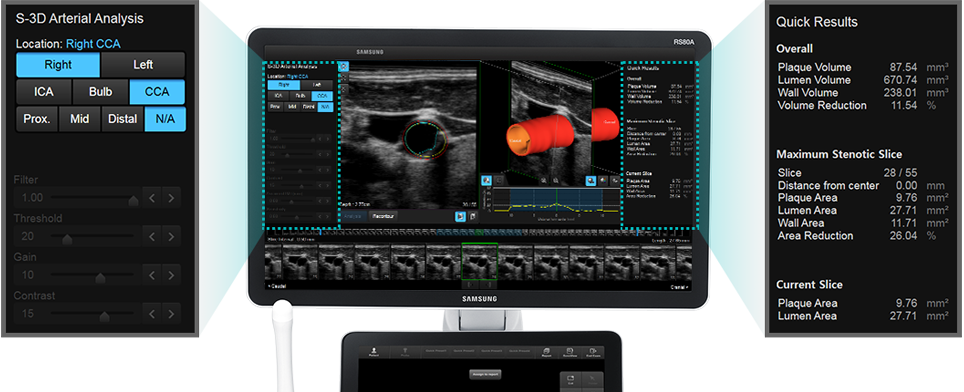 Immagini a monitor ottenute con software S-3D Arterial Analysis