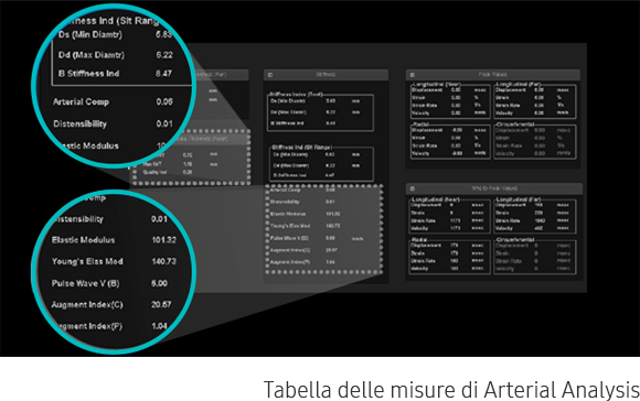 Valutazione quantitativa ottenuta con software Arterial Analysis