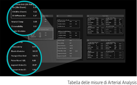 Valutazione quantitativa ottenuta con software Arterial Analysis