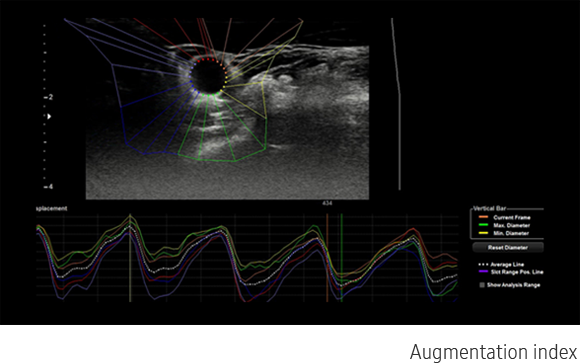 Valutazione qualitativa ottenuta con software Arterial Analysis