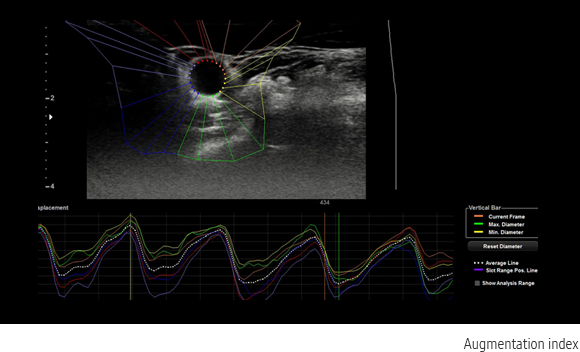 Arterial Analysis