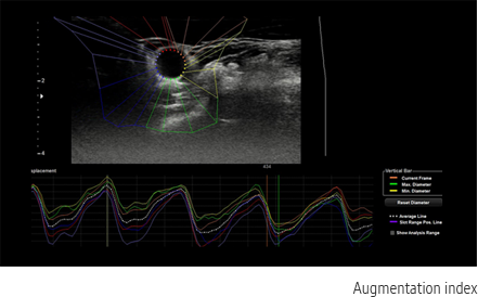 Valutazione qualitativa ottenuta con software Arterial Analysis