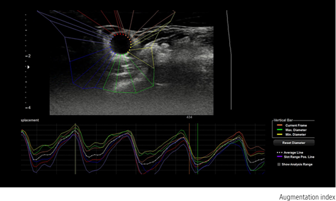 Arterial Analysis