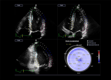 Valutazione ottenuta con software Strain+ 