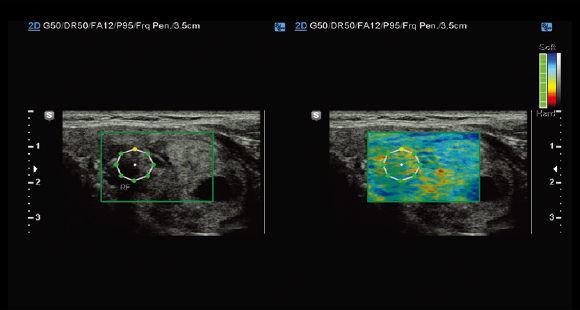 Immagini ottenute con software E-strain