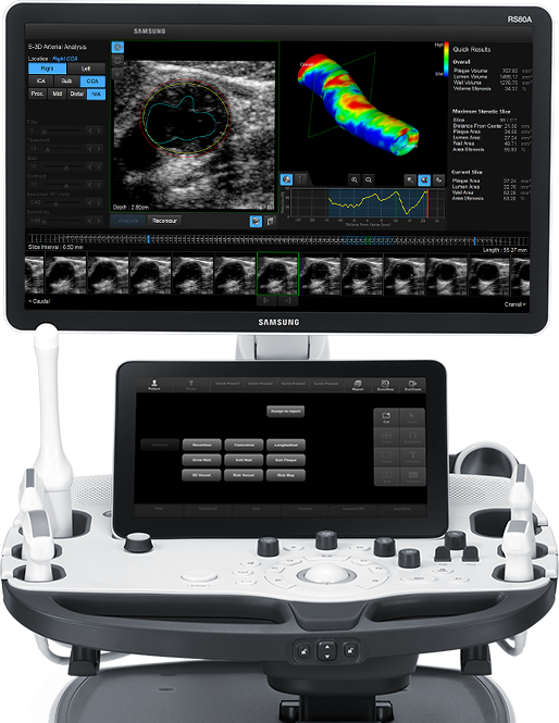 Ecografo RS80A with Prestige in funzione