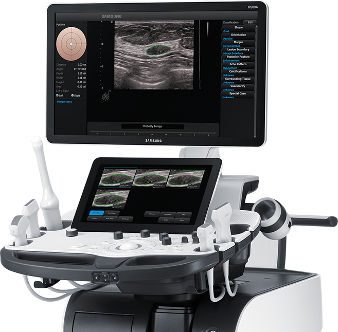 Ecografo RS80A with Prestige in funzione con software S-Detect attivo