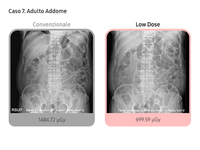 Case 7. Adult Abdomen