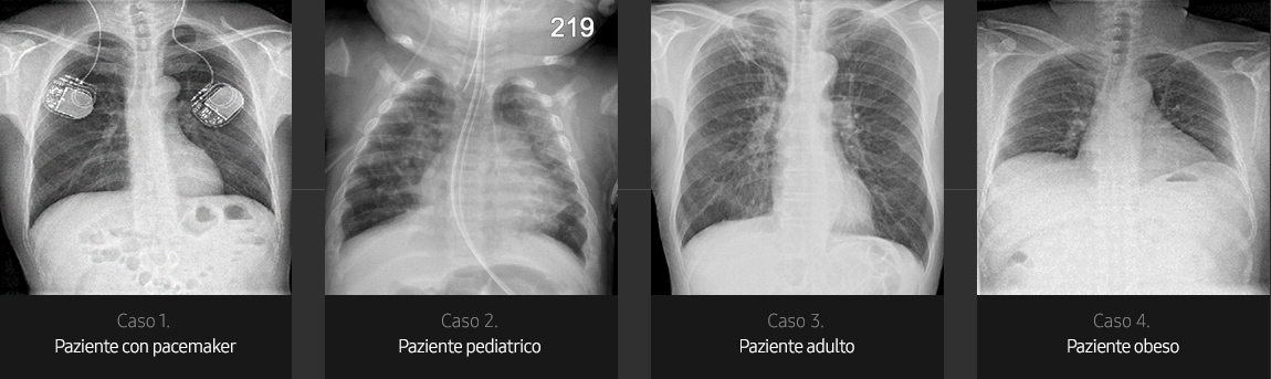 Immagini radiografiche in diverse condizioni di esame