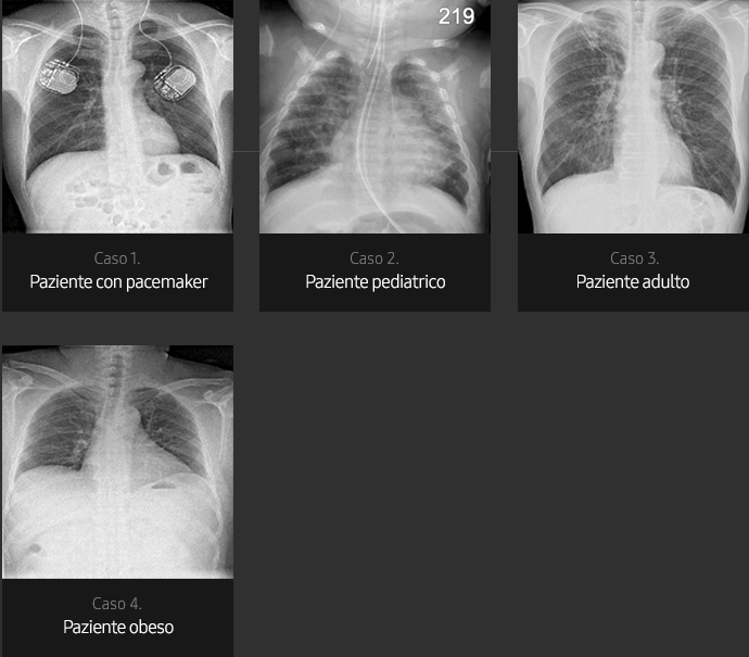 Immagini radiografiche in diverse condizioni di esame