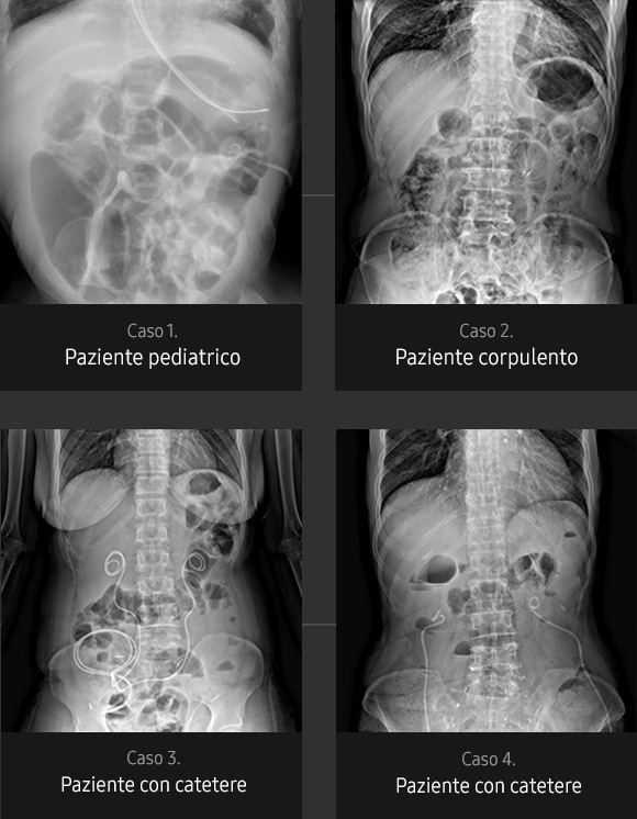 Immagini radiografiche in diverse condizioni di esame