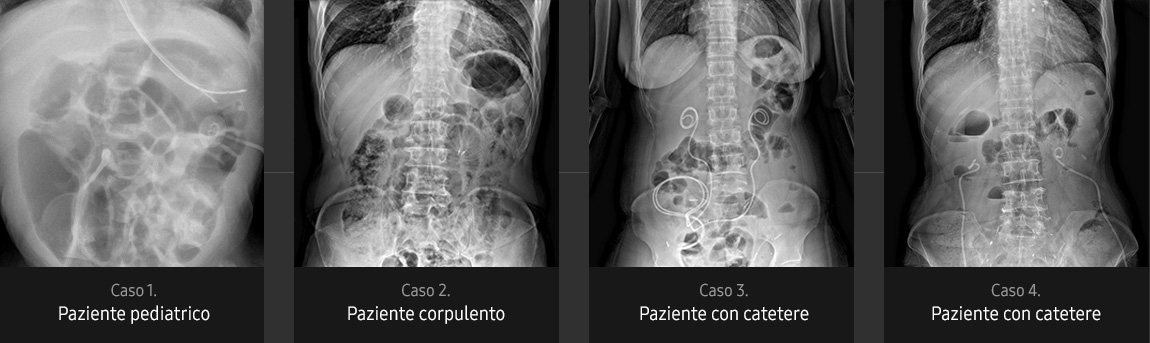 Immagini radiografiche in diverse condizioni di esame