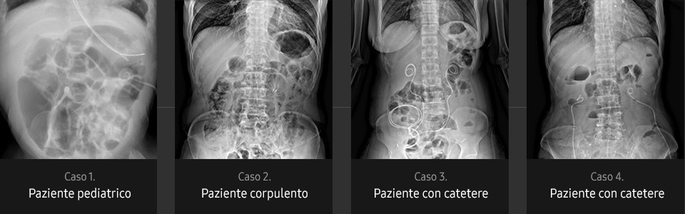 Immagini radiografiche in diverse condizioni di esame