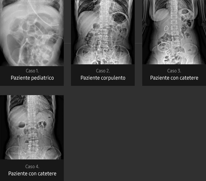 Immagini radiografiche in diverse condizioni di esame